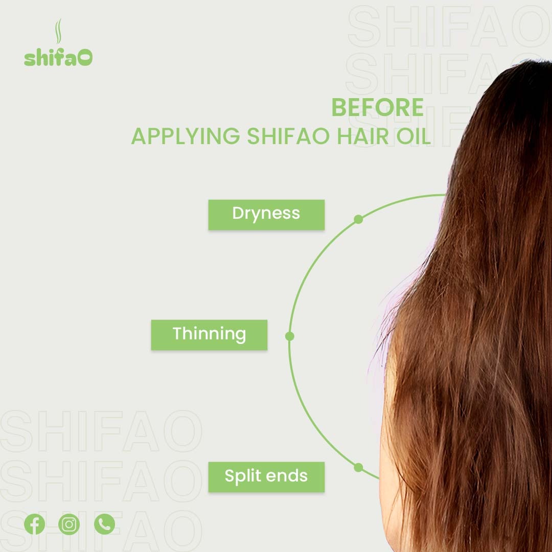 ShifaO Rosemary Mint Scalp Oil